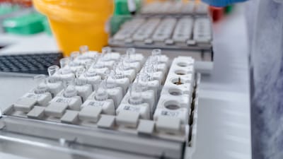 Gros plan sur des tubes à essai dans un laboratoire avec un technicien manipulant des échantillons. Idéal pour des visuels de recherche scientifique.