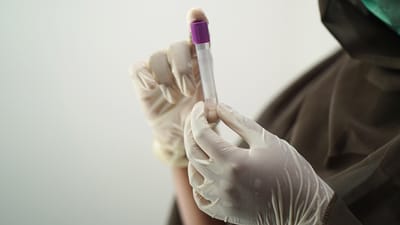 test sanguin, échantillon de sang, technologie médicale, technologue médical, gants chirurgicaux, masque facial, goûter, employé de l'hôpital, laboratoire, test sanguin, laboratoire, laboratoire, laboratoire, laboratoire, laboratoire