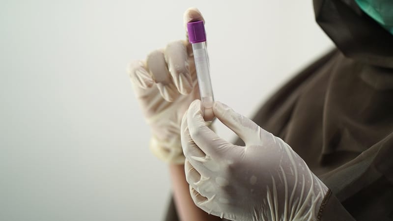 test sanguin, échantillon de sang, technologie médicale, technologue médical, gants chirurgicaux, masque facial, goûter, employé de l'hôpital, laboratoire, test sanguin, laboratoire, laboratoire, laboratoire, laboratoire, laboratoire