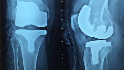 docteur, orthopédie, radiographie, le genou, orthopédie, orthopédie, orthopédie, orthopédie, orthopédie, radiographie, radiographie, radiographie, radiographie, le genou, le genou