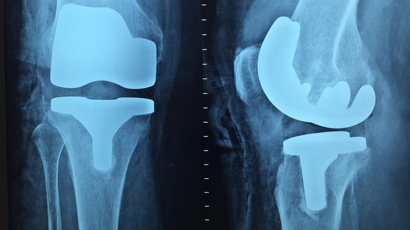 docteur, orthopédie, radiographie, le genou, orthopédie, orthopédie, orthopédie, orthopédie, orthopédie, radiographie, radiographie, radiographie, radiographie, le genou, le genou
