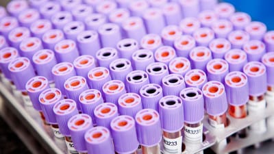 laboratoire, échantillons, tubes, échantillons, échantillons, échantillons, échantillons, échantillons