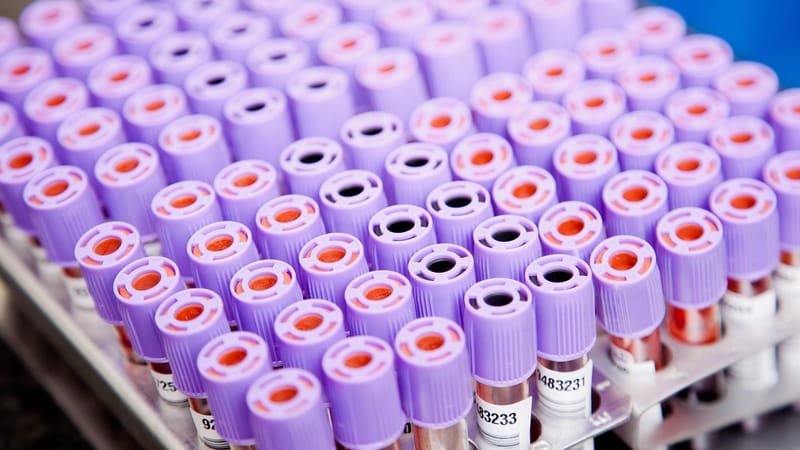laboratoire, échantillons, tubes, échantillons, échantillons, échantillons, échantillons, échantillons