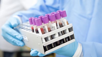 goûter, laboratoire, scientifique, médical, santé, test, science, soins de santé, recherche, tube, bleu de santé, bleu médical, le bleu de la science, bleu recherche, bleu de laboratoire, essai au bleu de, sang bleu, bleu de soins de santé